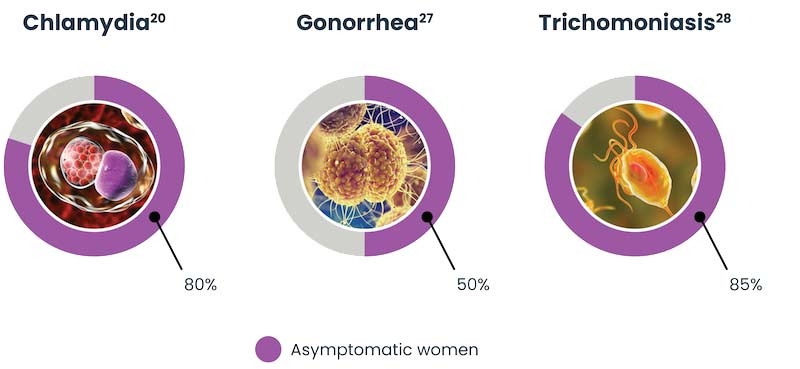 Chart displaying asymptomatic ratio for Chlamydia, Gonorrehea, and Trichomoniasis.